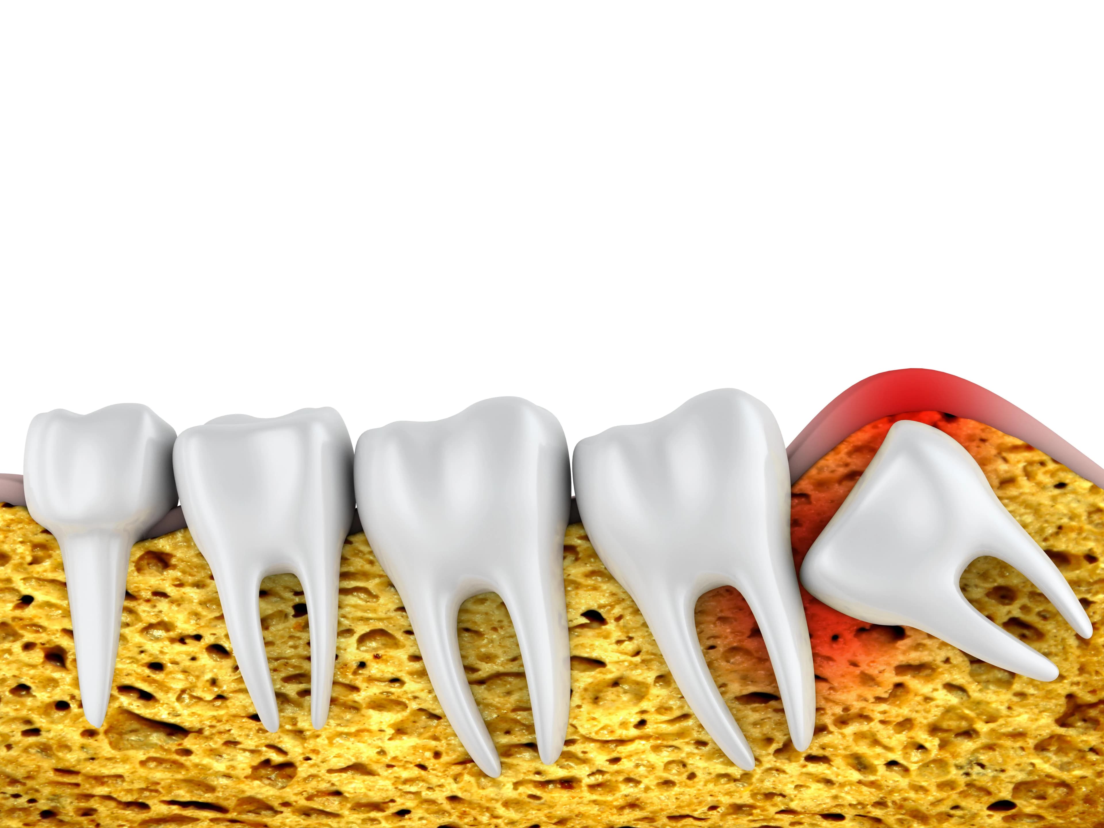 Consulta no dentista na CC Clinic, em Águeda, para prevenção de doenças orais.