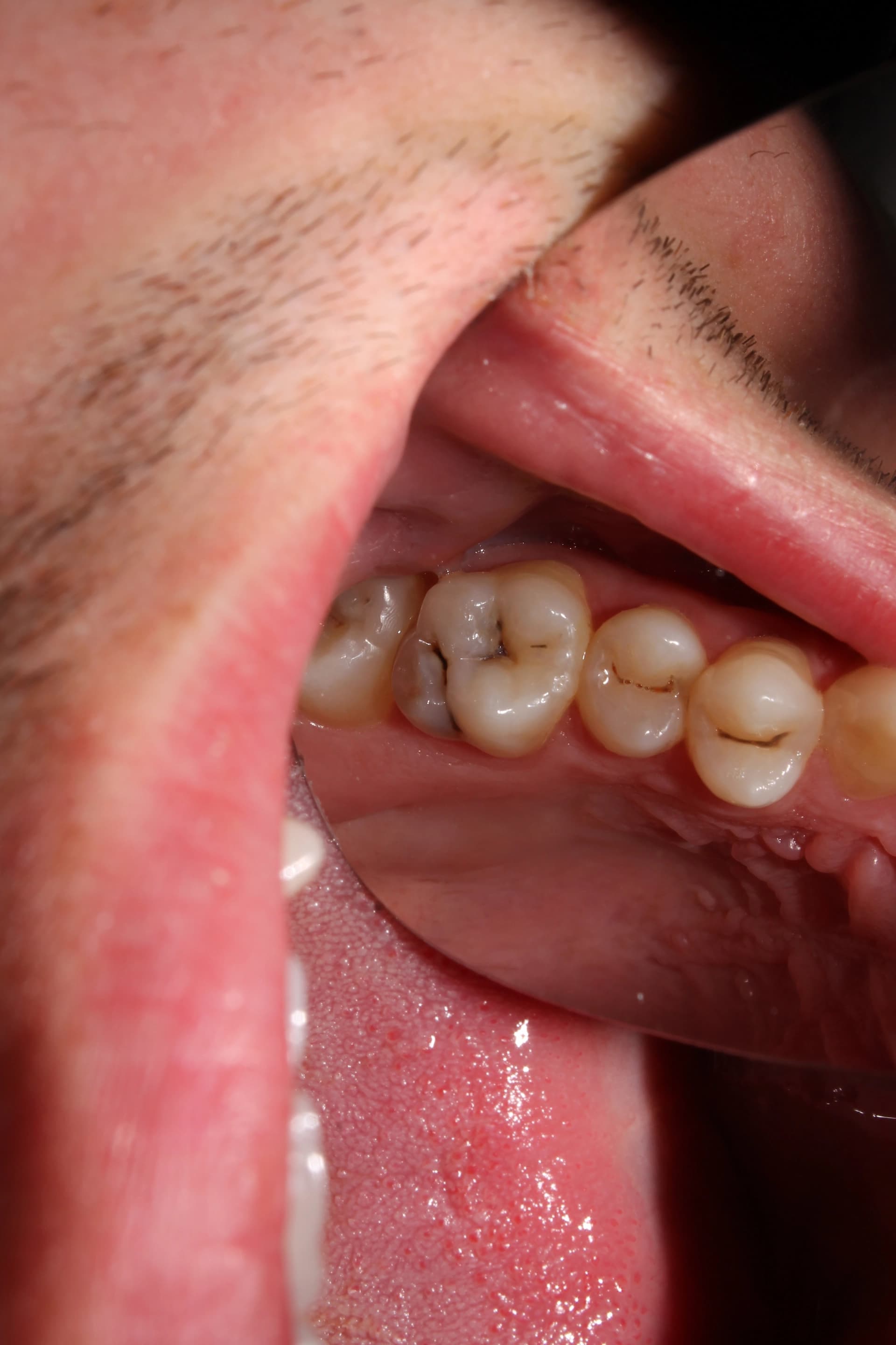 Consulta no dentista na CC Clinic, em Águeda, para prevenção de doenças orais.