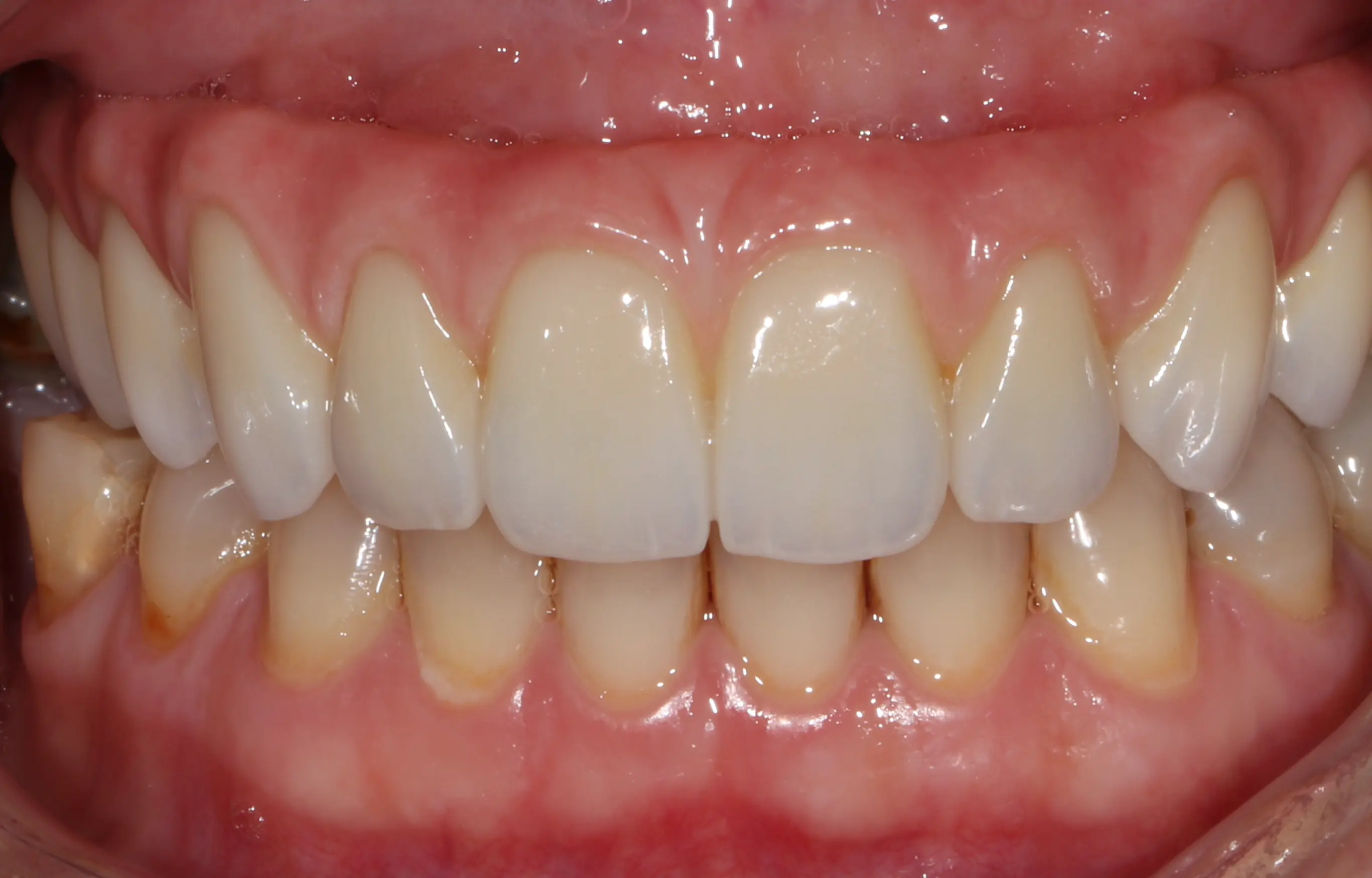 second image
