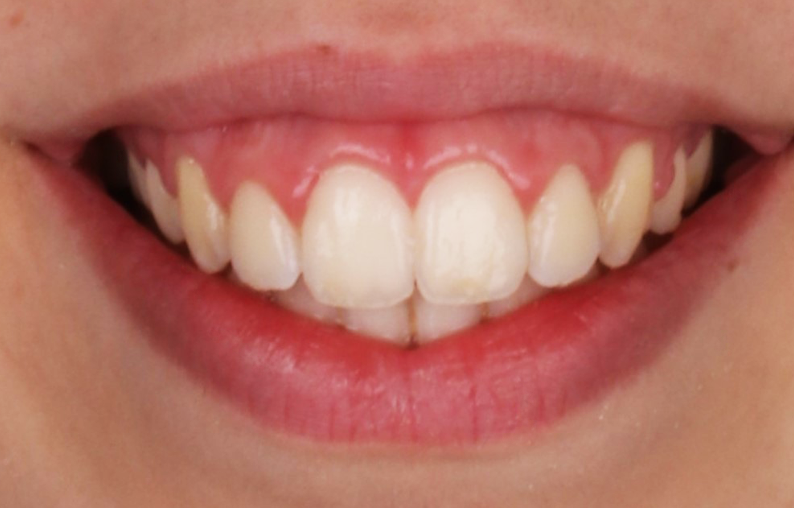 second image