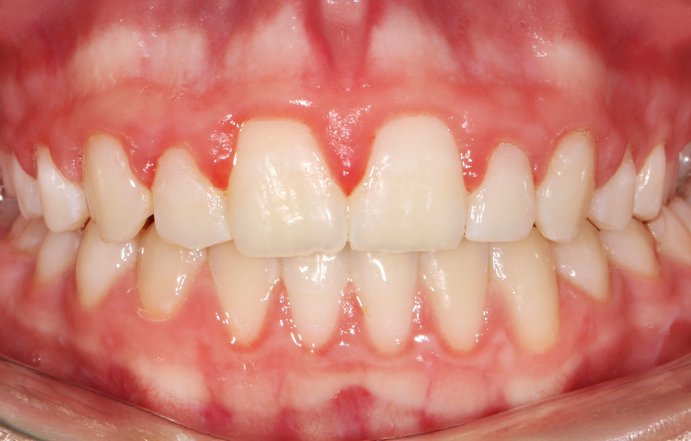 second image